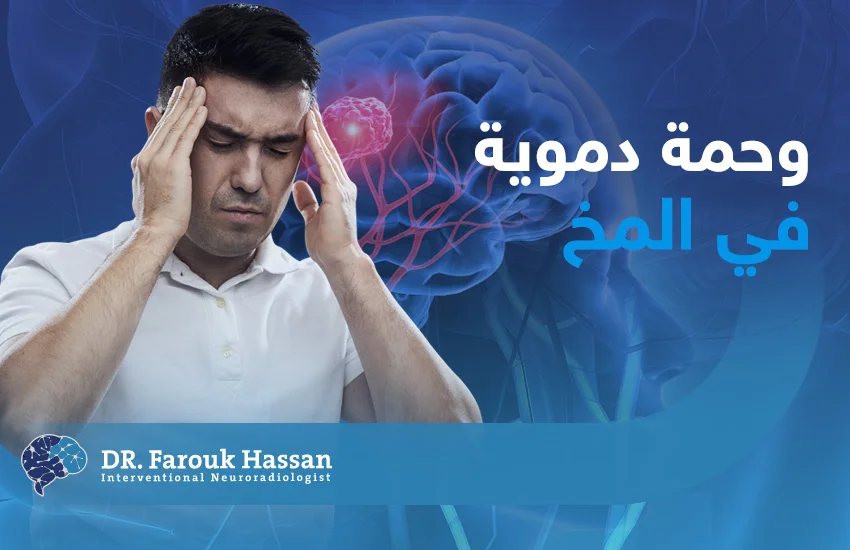 وحمه دمويه في المخ 2026 في المخ و علاجها د فاروق حسن